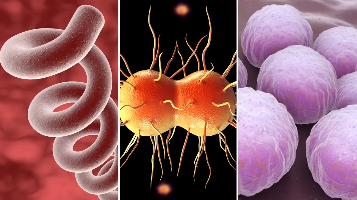 Europa registra un aumento sin precedentes en casos de gonorrea y sífilis en la última década