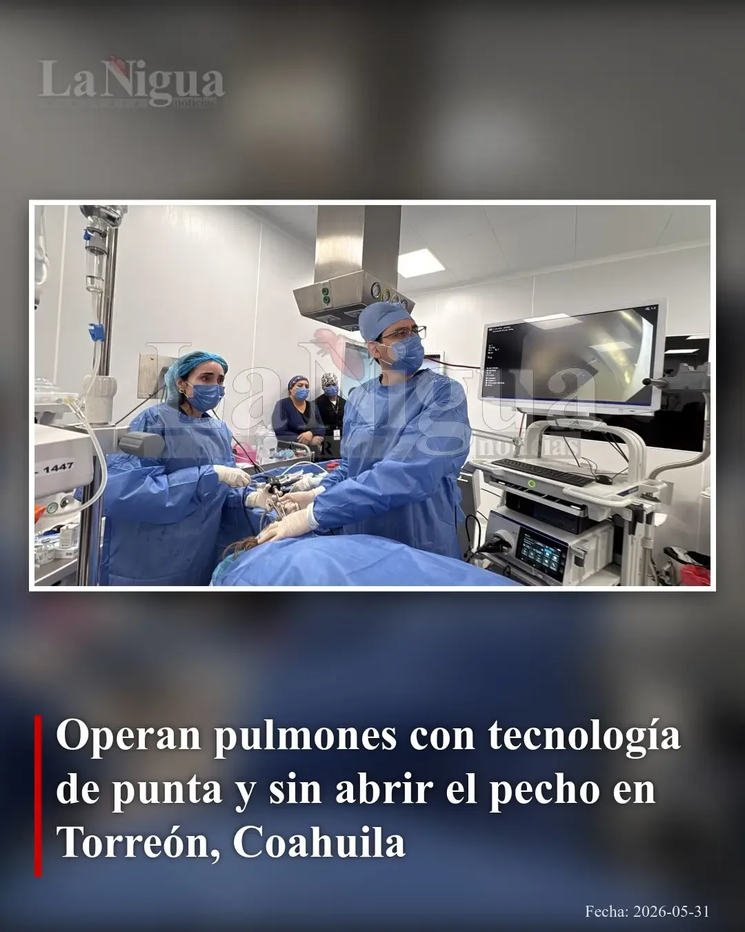 Realizan en Torreón cirugía pulmonar avanzada sin abrir el pecho con tecnología mínimamente invasiva