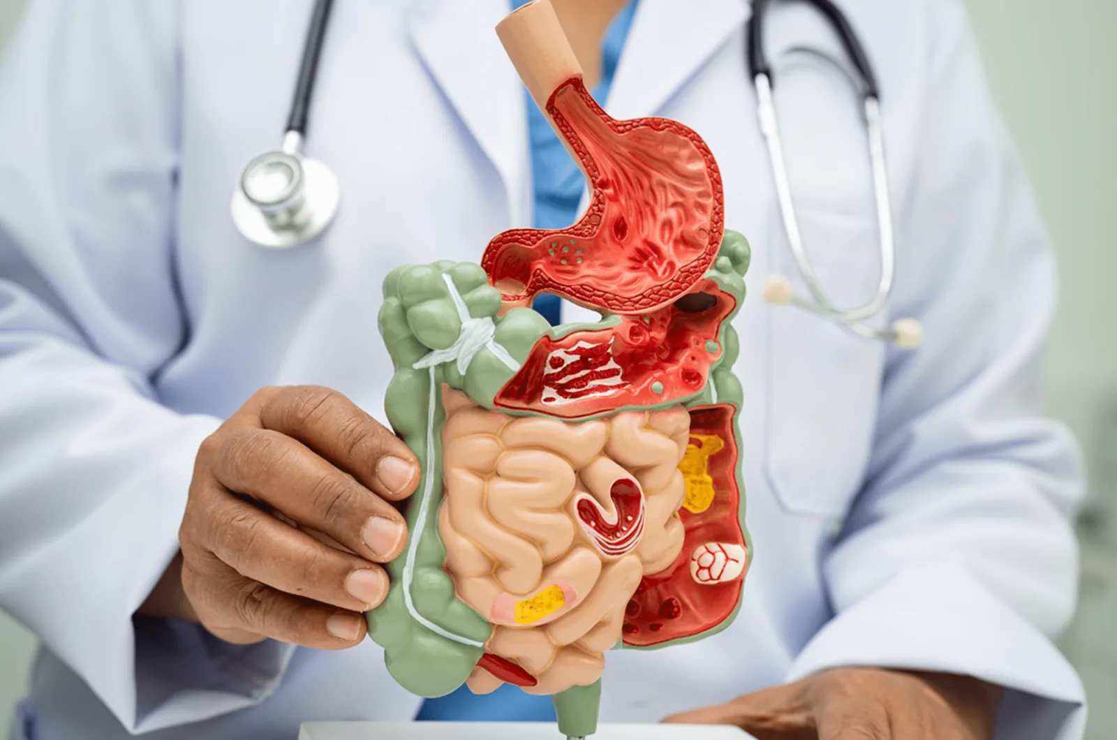Yucatán encabeza la península en incidencia de cinco tipos de cáncer digestivo
