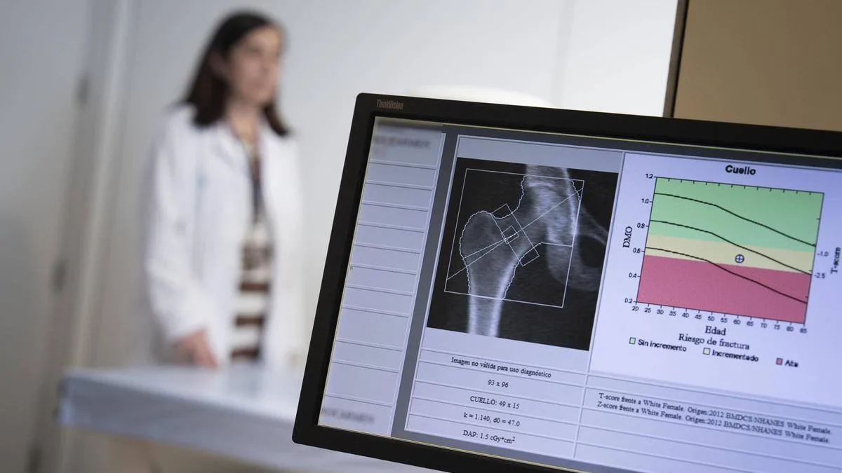 España carece de respuesta efectiva ante la osteoporosis tras fracturas en mujeres mayores