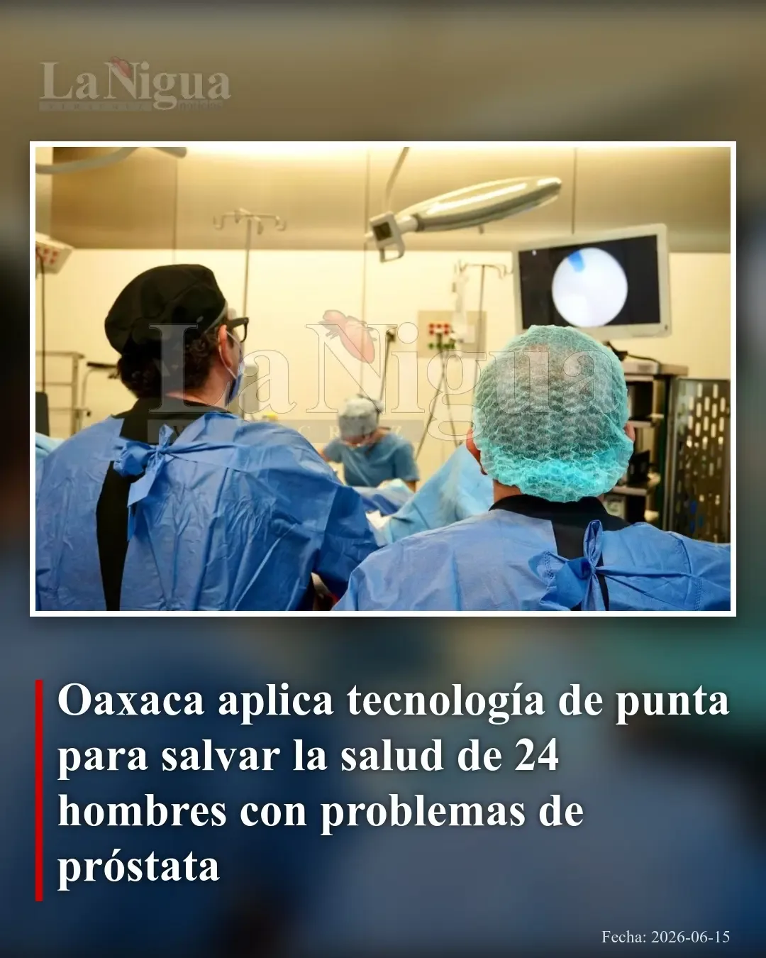 Oaxaca incorpora tecnología láser avanzada para tratar problemas de próstata en hombres