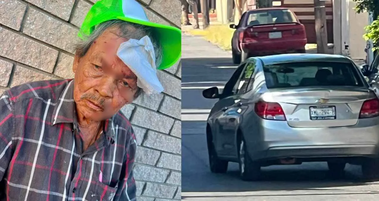 Adulto mayor queda herido tras ser atropellado y conductor escapa en Ciudad Victoria