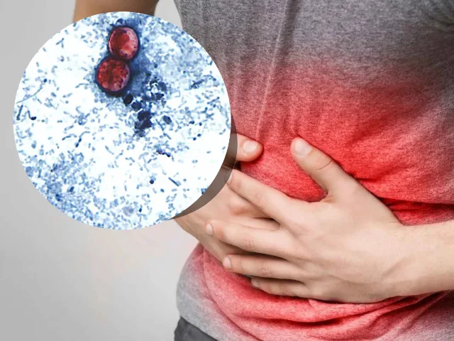 Estados Unidos enfrenta un brote masivo de cyclosporiasis con miles de afectados